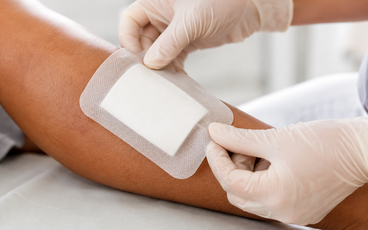 Advanced Wound Dressings