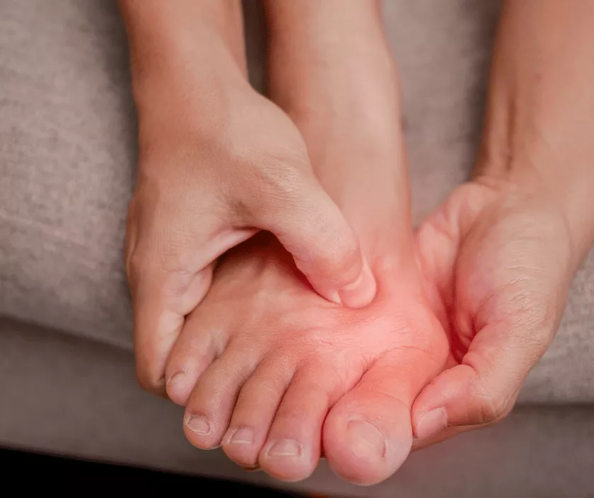 Bunion Surgery
