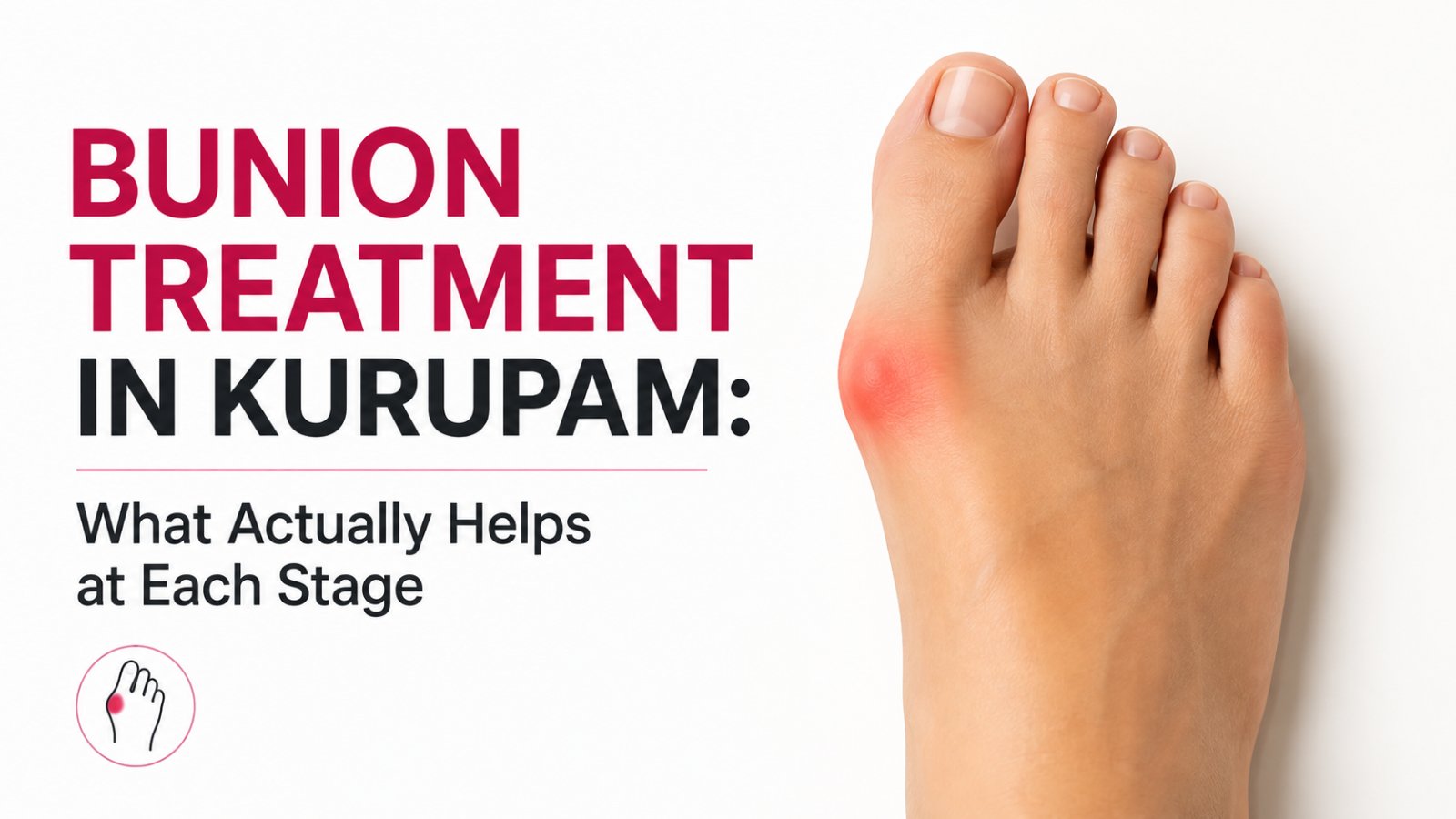 Bunion Treatment in Kurupam: What Actually Helps at Each Stage
