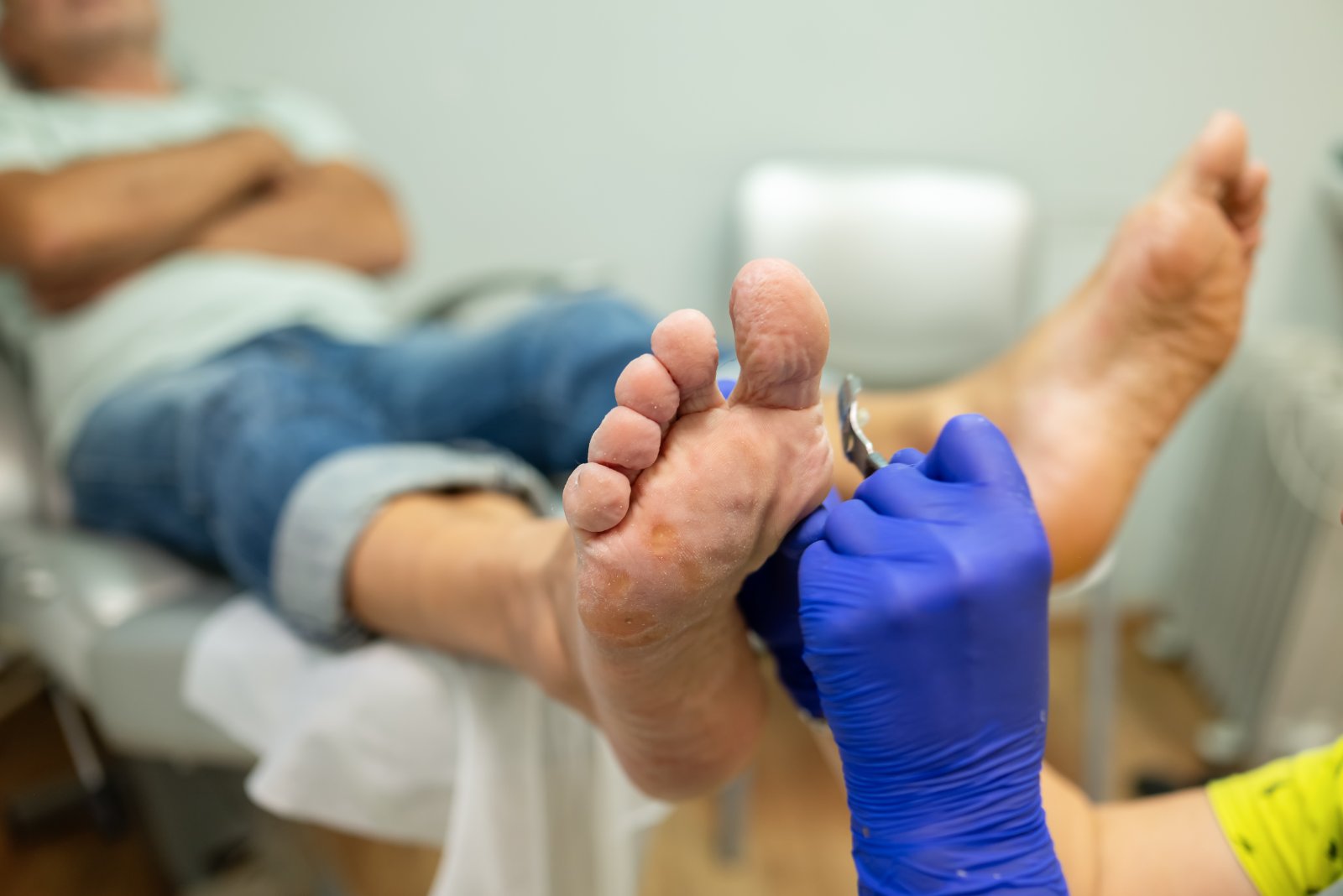 Diabetic Foot Infection Treatment in Surat: Acting Fast to Save the Foot
