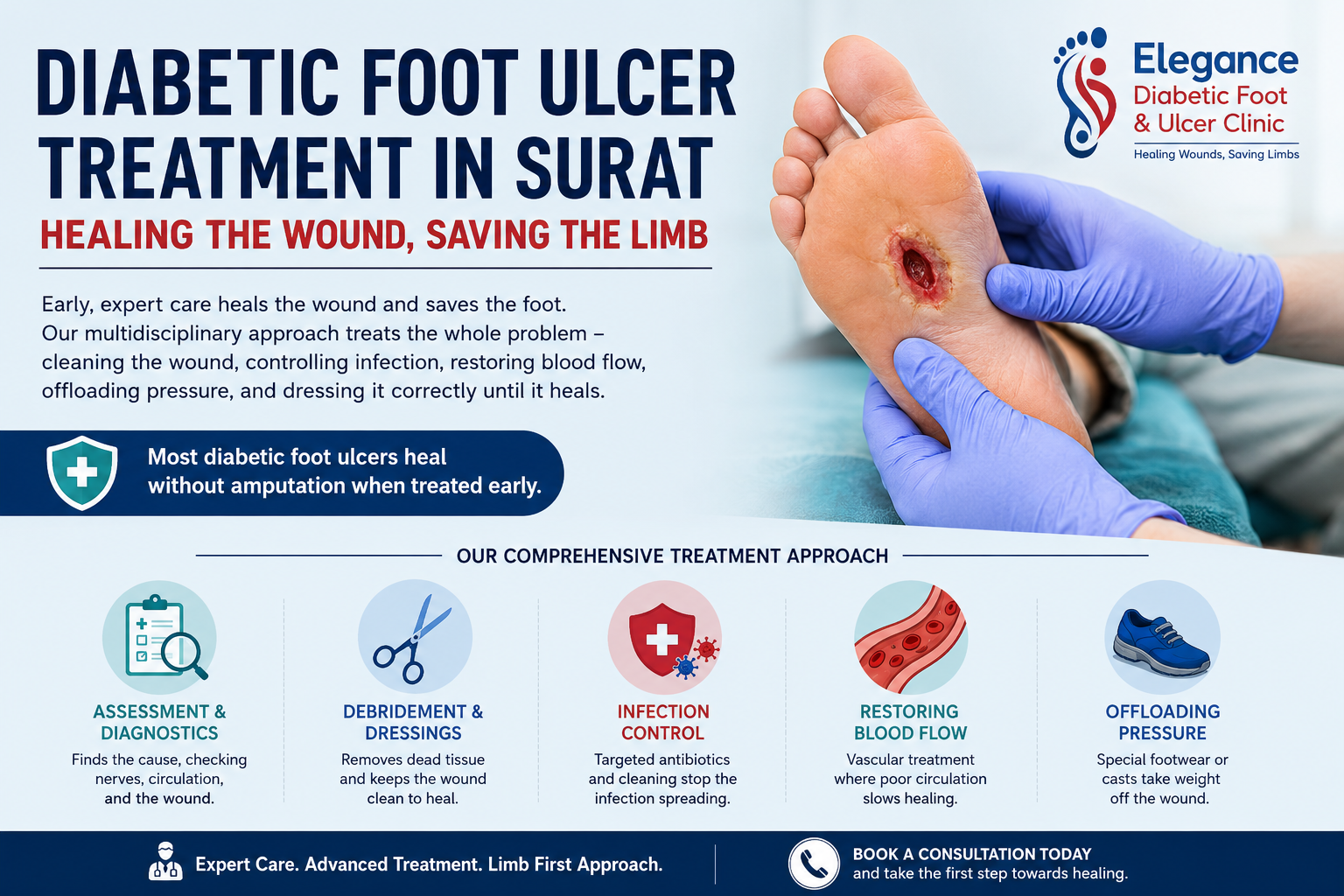 Diabetic Foot Ulcer Treatment in Surat: Healing the Wound, Saving the Limb