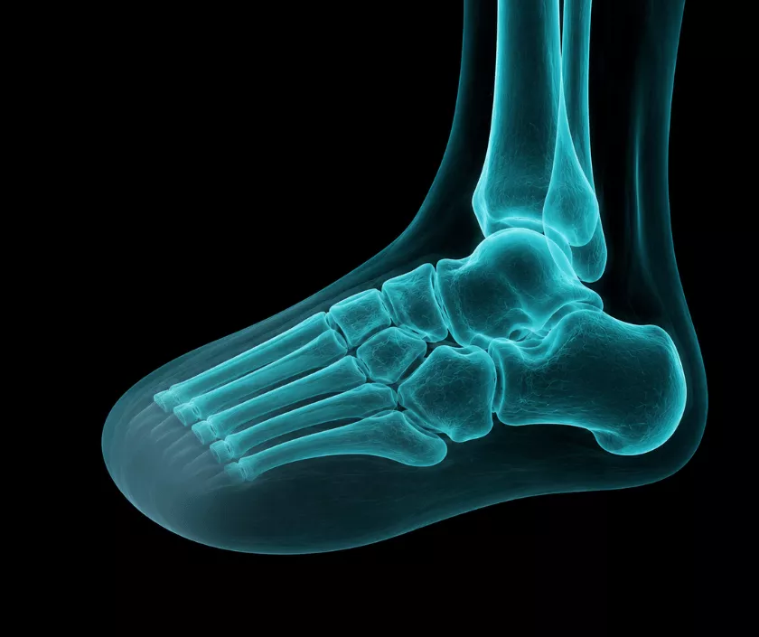 Forefoot Amputation
