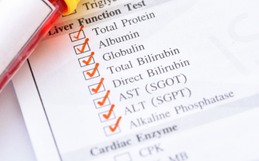 Kidney / Liver Function Tests, ESR & CRP