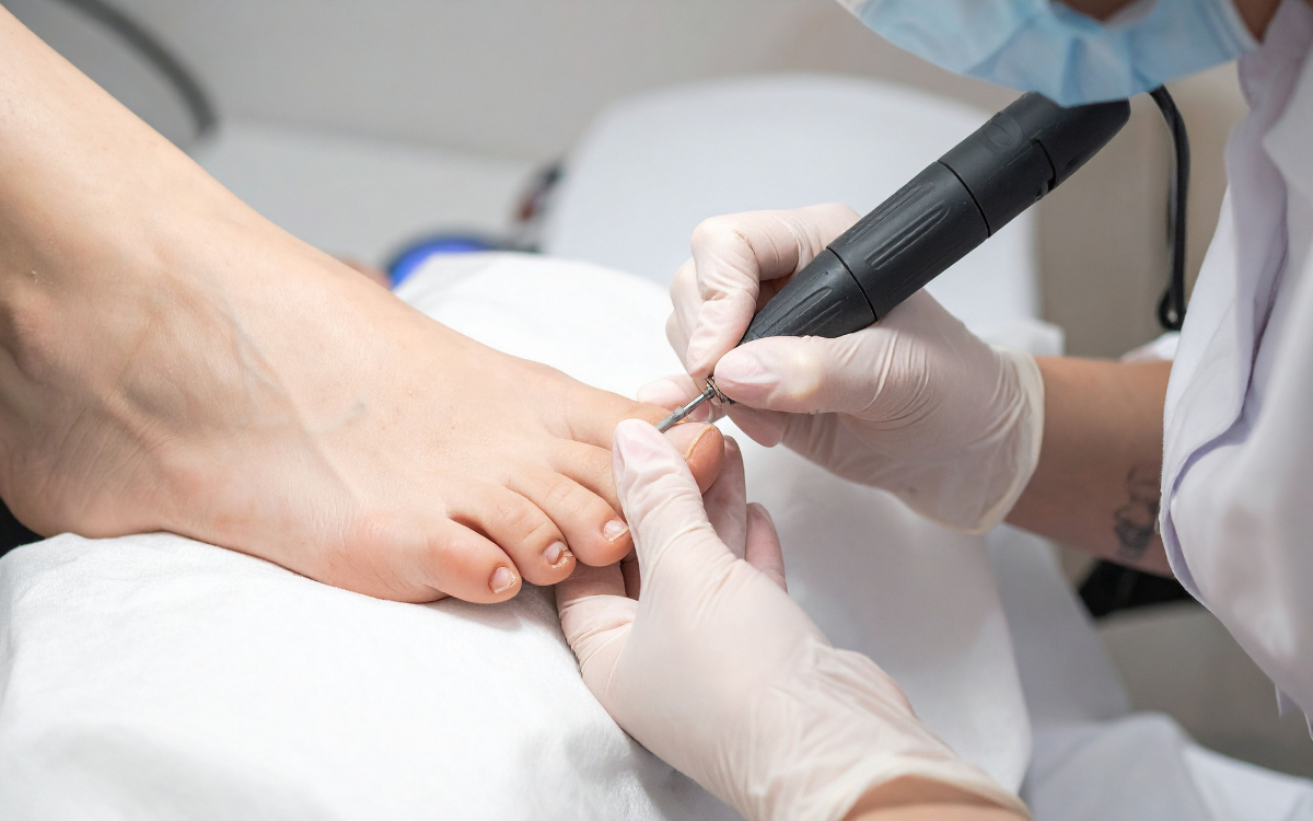 Medical Pedicure at Elegance Diabetic Foot & Ulcer Clinic