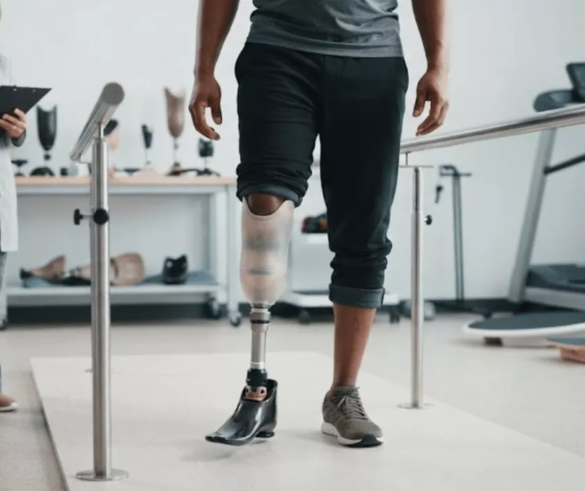 Prosthetic Rehabilitation