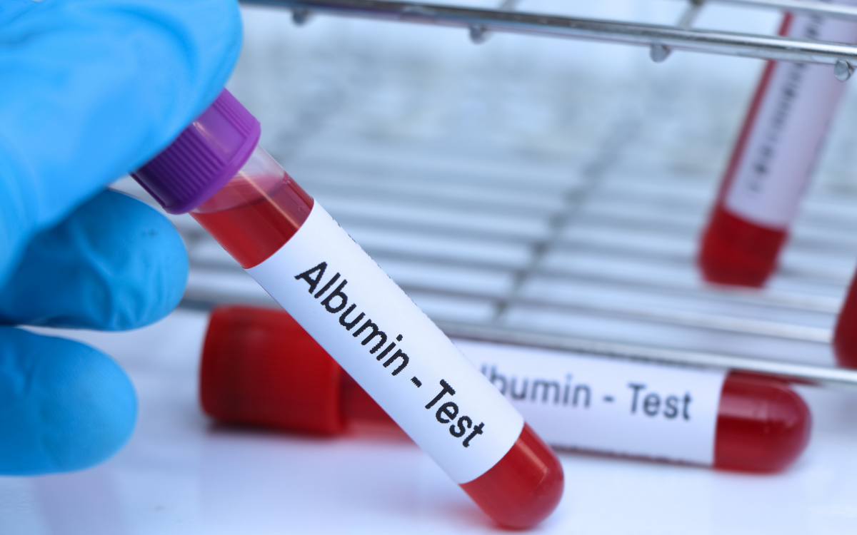 Serum Albumin