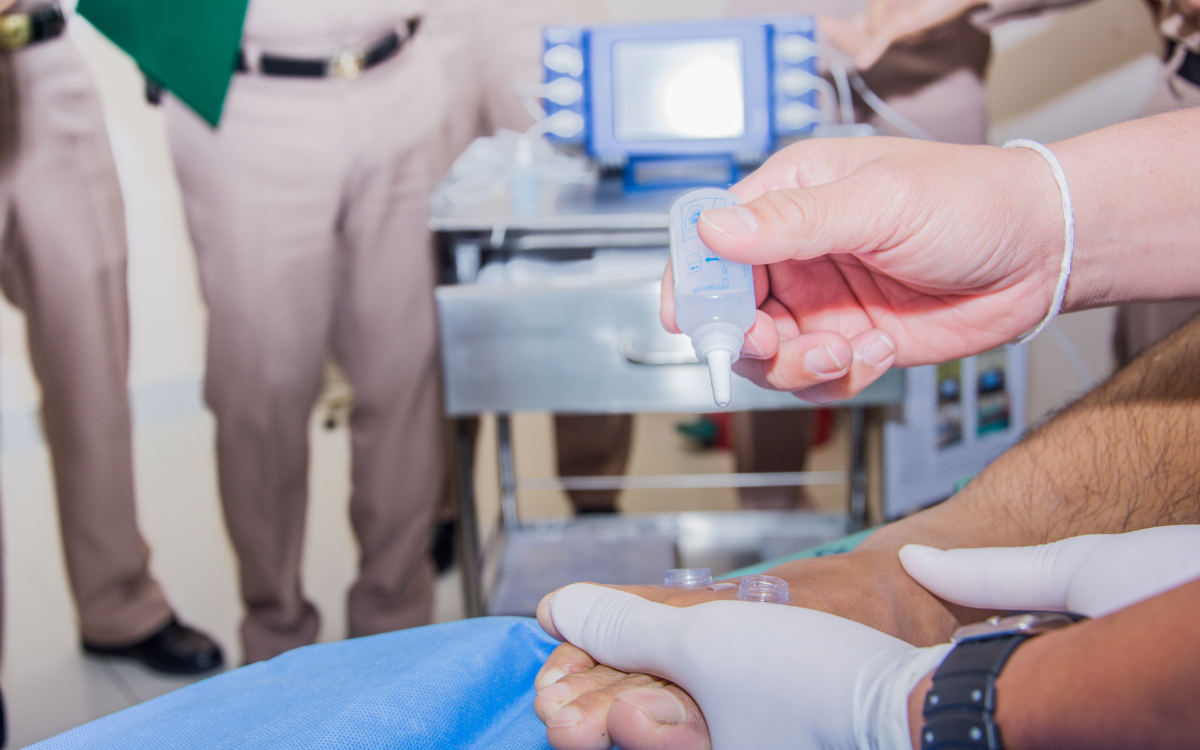 Transcutaneous Oxygen Measurement