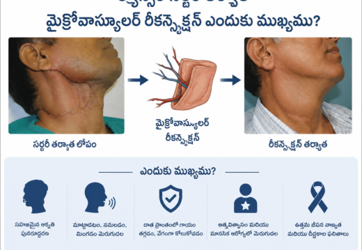 microvascular reconstruction