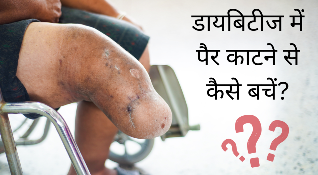 डायबिटीज में पैर काटने से कैसे बचें