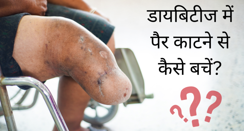 डायबिटीज में पैर काटने से कैसे बचें
