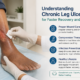 chronic leg ulcer